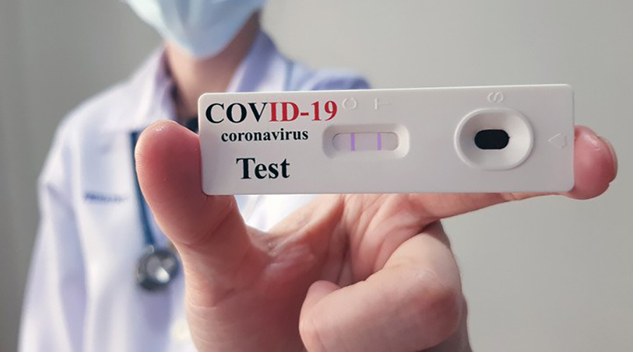 Test sierologico Covid